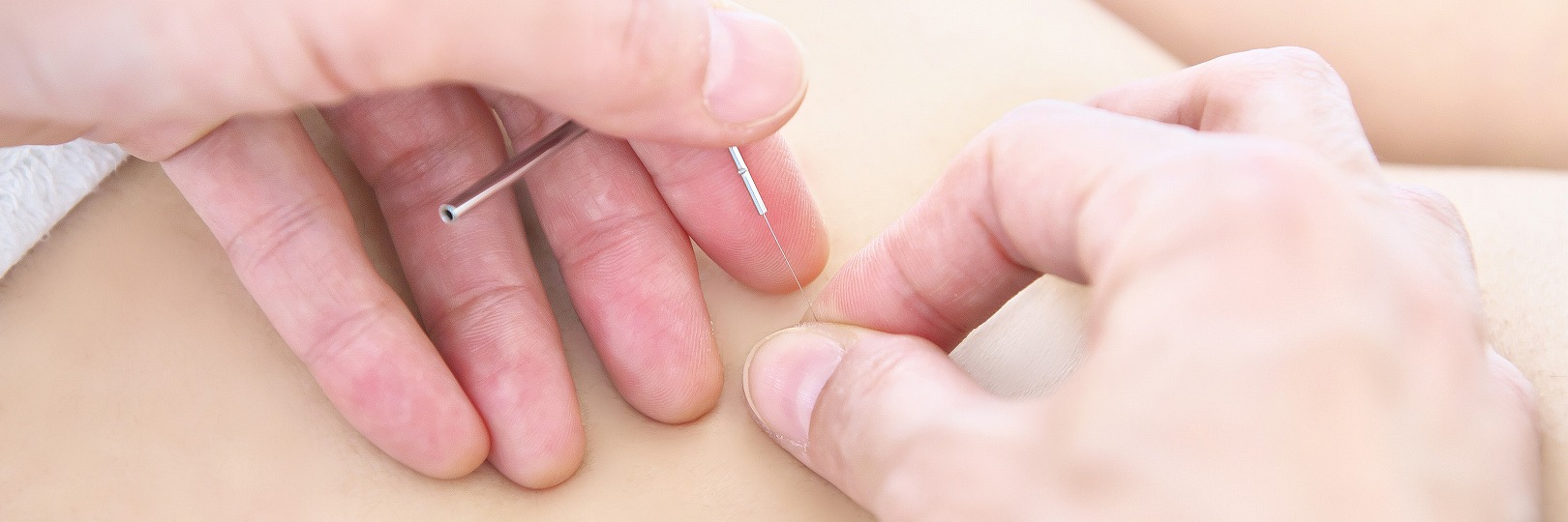 治療している手