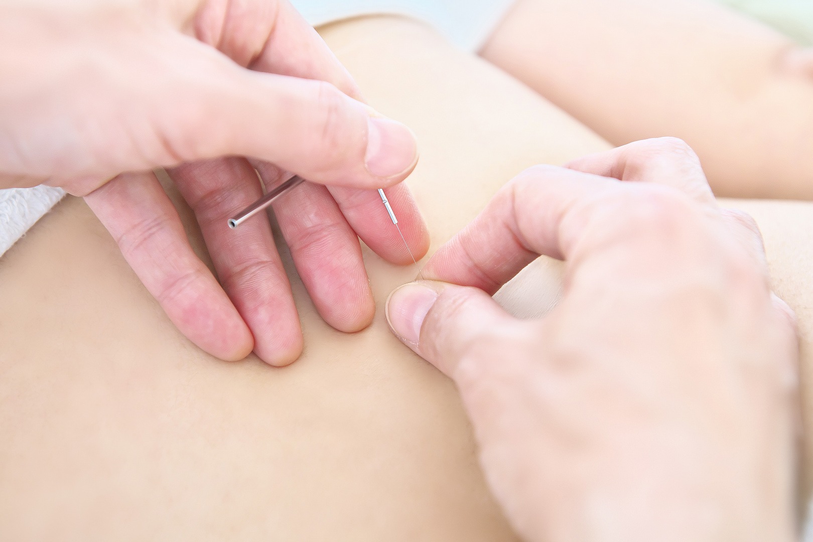 治療している手